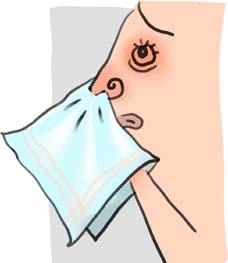 AlergijskiRinitis3